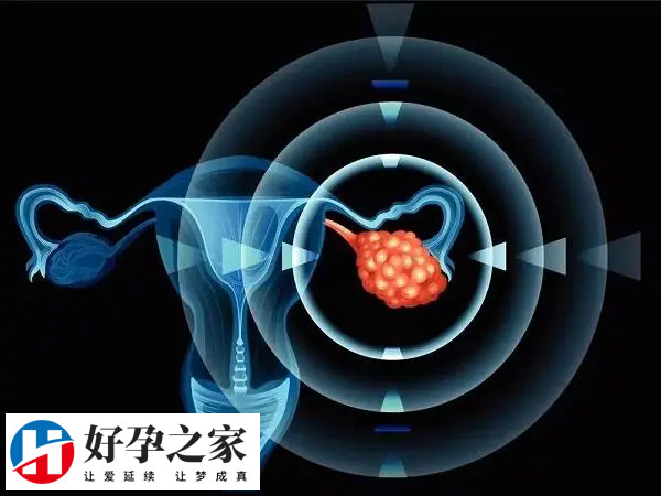 三代试管10万元能否成功