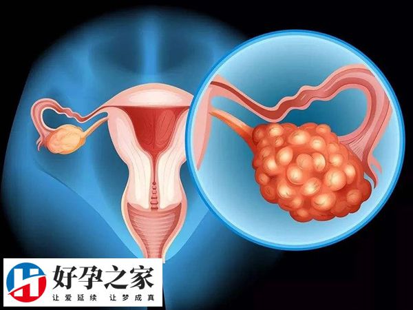 amh升高但不是多囊卵巢可能属于正常情况