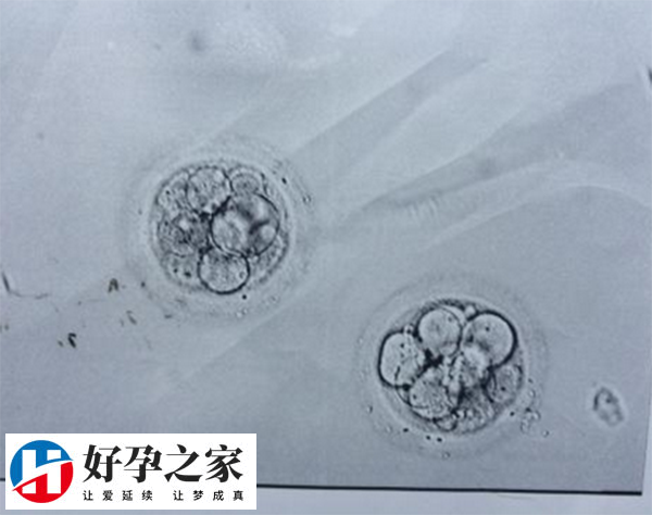 囊胚活检淘汰率是由胚胎的质量决定