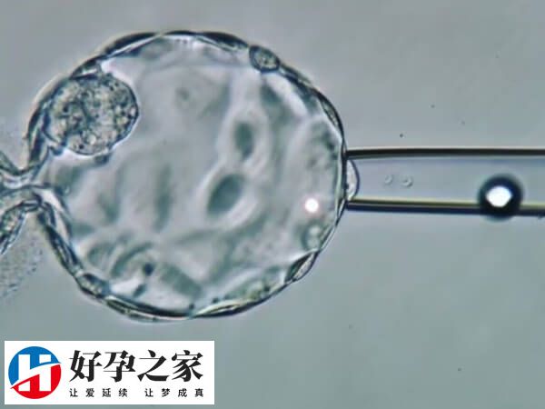 二代试管婴儿采用单精子注射技术