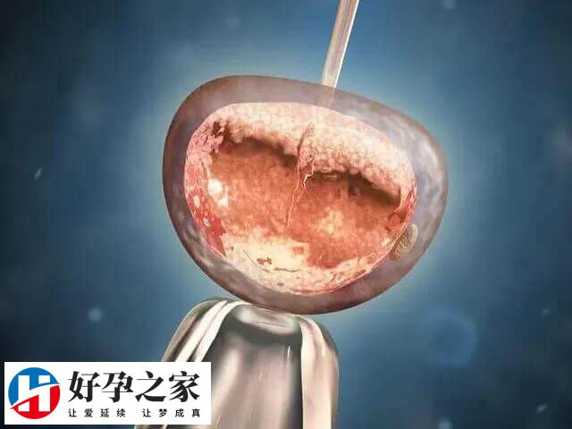 自然周期移植指在自然状态下移植