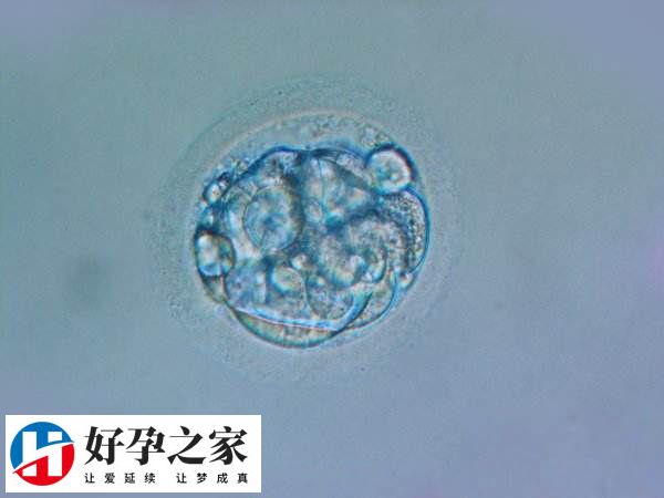 患者做试管婴儿的成功率并非百分百
