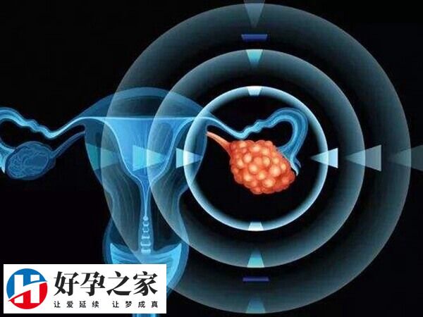 卵巢储备功能随着年龄的增加而下降