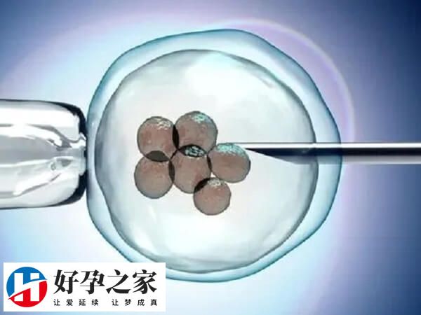 双胎妊娠的早产风险大约为单胎妊娠的7-10倍