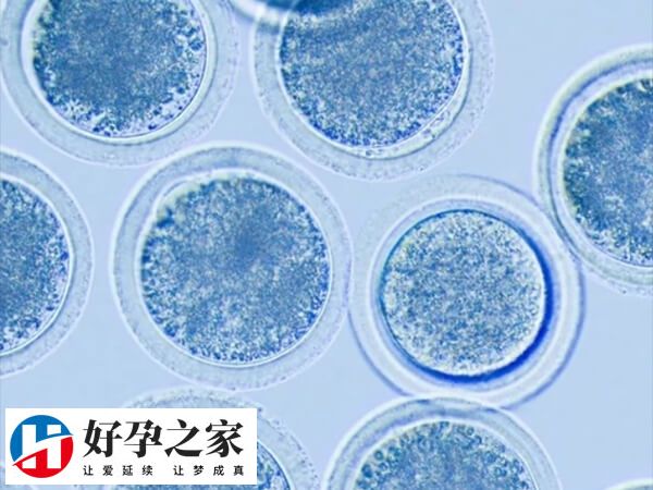 多胎妊娠是怀孕两个或以上胎儿的情况
