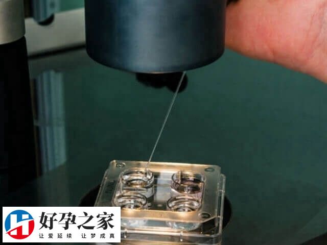 随着年龄增长卵子染色体异常的概率增加