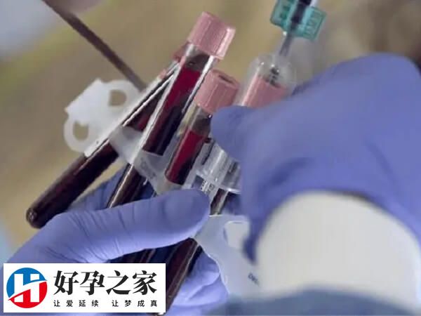 抽血检查血清中的六种激素