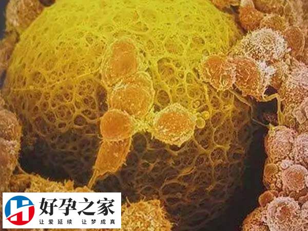 超促排卵方案适用于卵泡发育不良